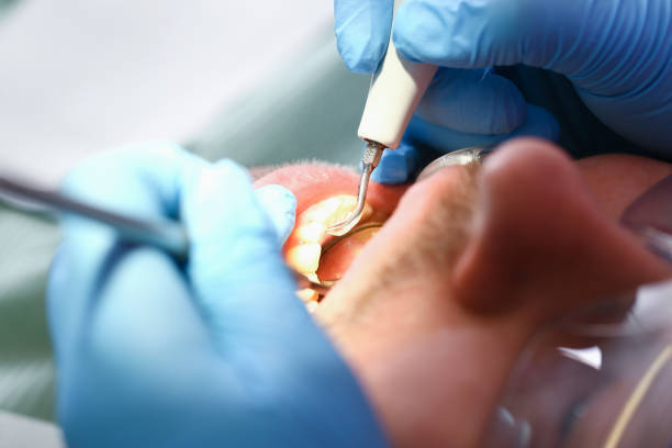 Best Tooth Infection Emergency Dentist  in Larimore, ND